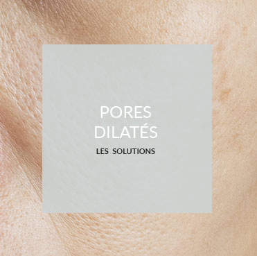 pores dilatés