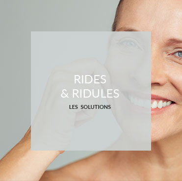 rides et ridules